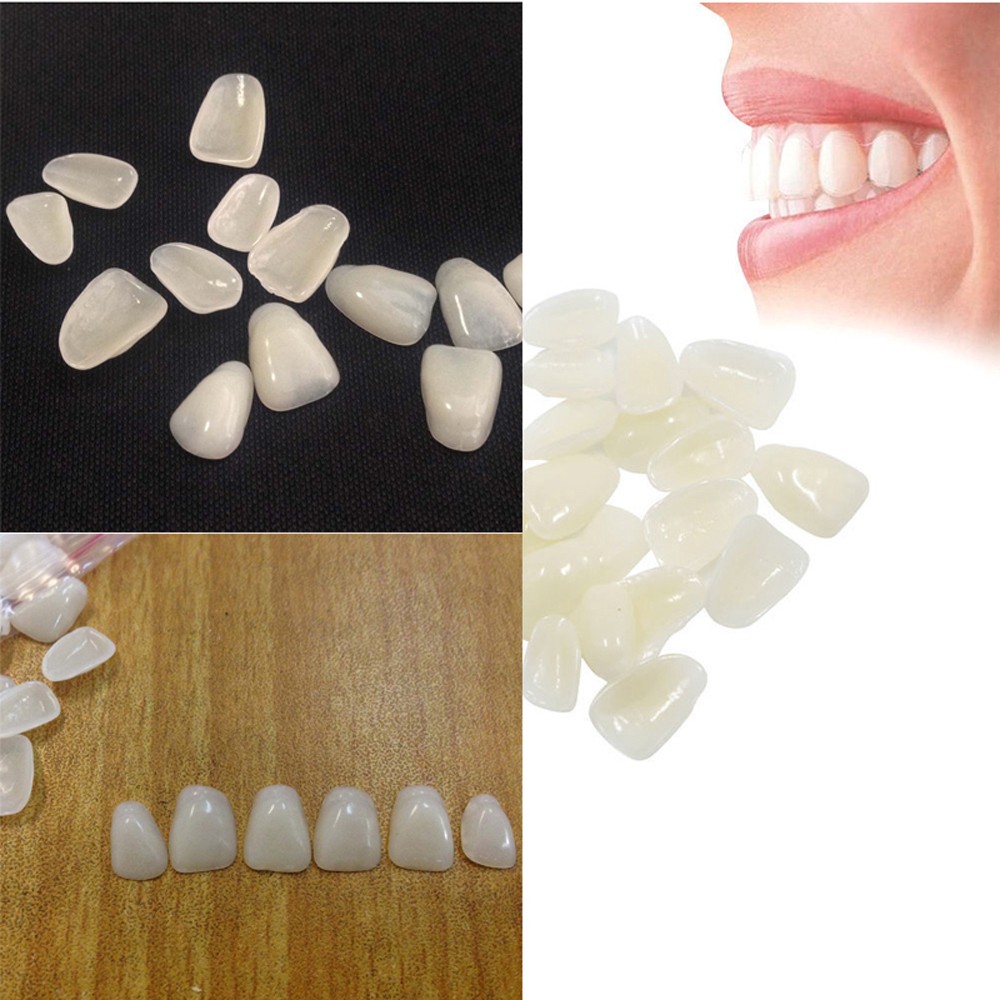 Teeth Whitening Mask - 70PCS/Package Dental Ultra-Thin Whitening Veneers Resin