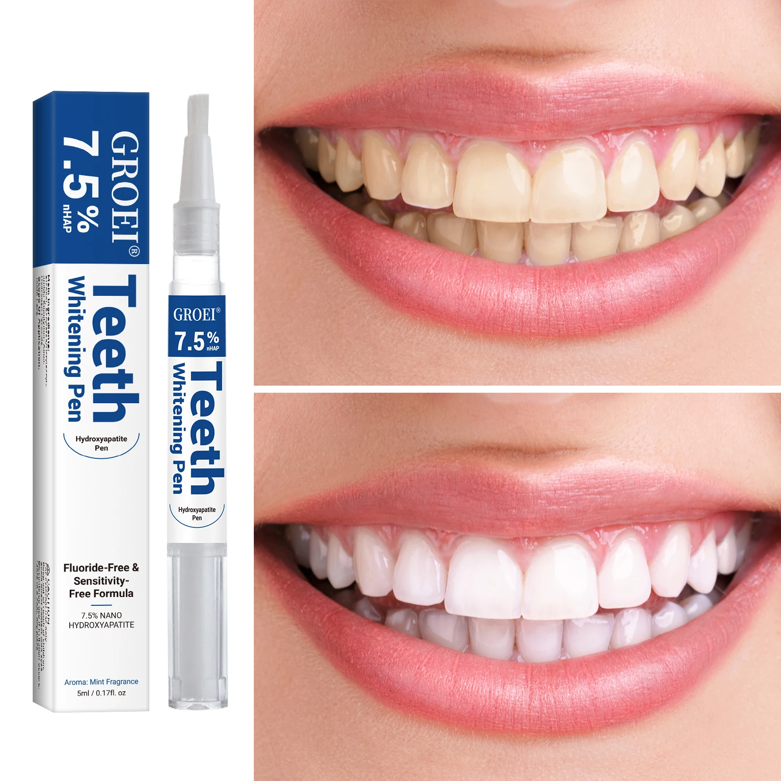 Hydroxyapatite Tooth Whitening - Teeth Whitening Results review and price