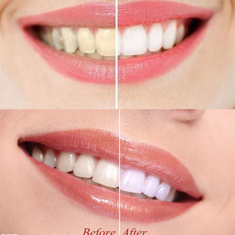 Bamboo Charcoal Teeth Tooth De - Teeth Whitening Instant review and price
