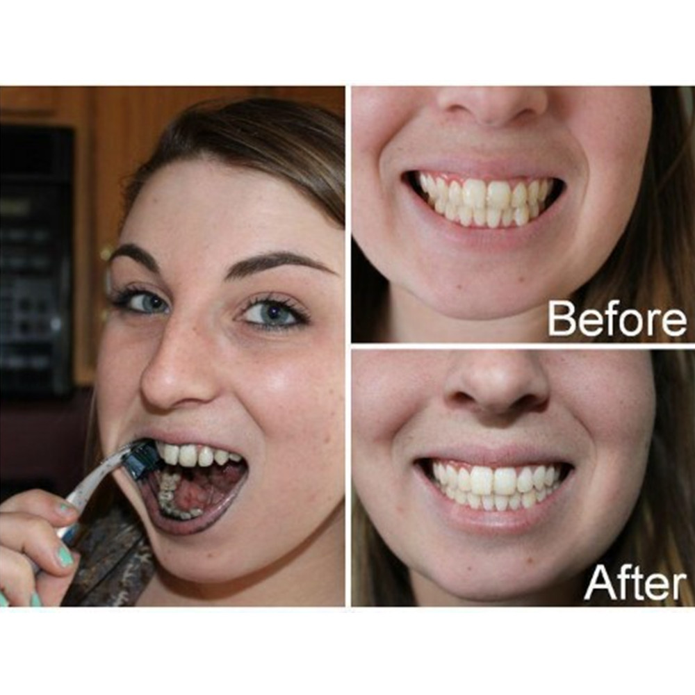 Bamboo Charcoal Teeth Tooth De - Teeth Whitening Instant review and price