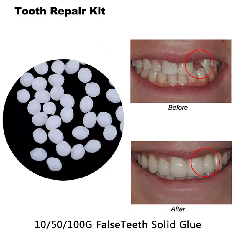 10g/bag Tooth Repair Kit-therm - Teeth Whitening Mask review and price