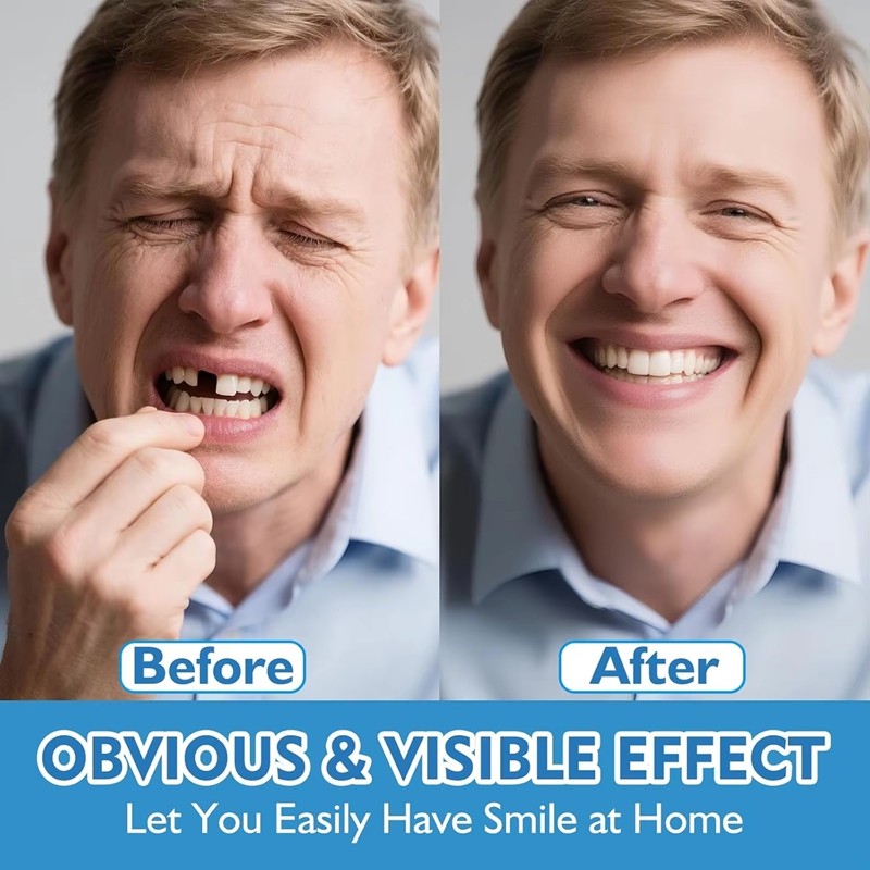 Full Set Silicone Dentures Upp - Teeth Whitening Instant review and price