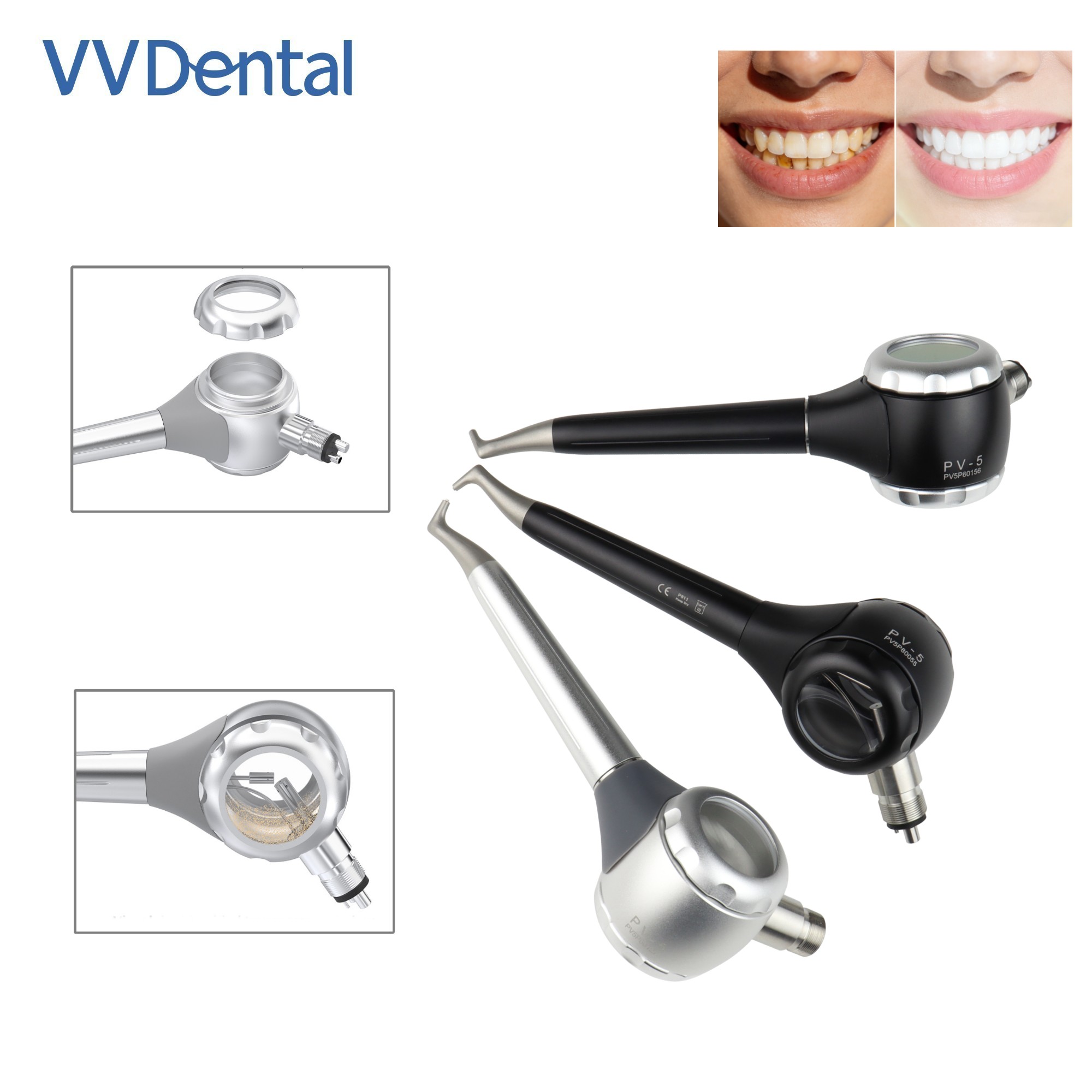 VV Dental 2/4 Holes Teeth Whit - Teeth Whitening Free review and price