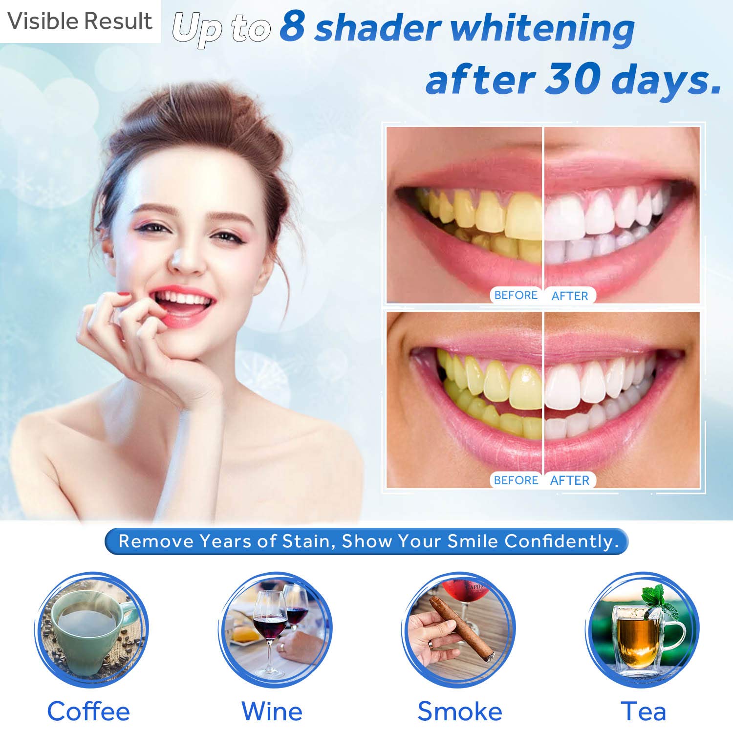 Teeth Whitening Gel Refill Syr - Teeth Whitening Results review and price