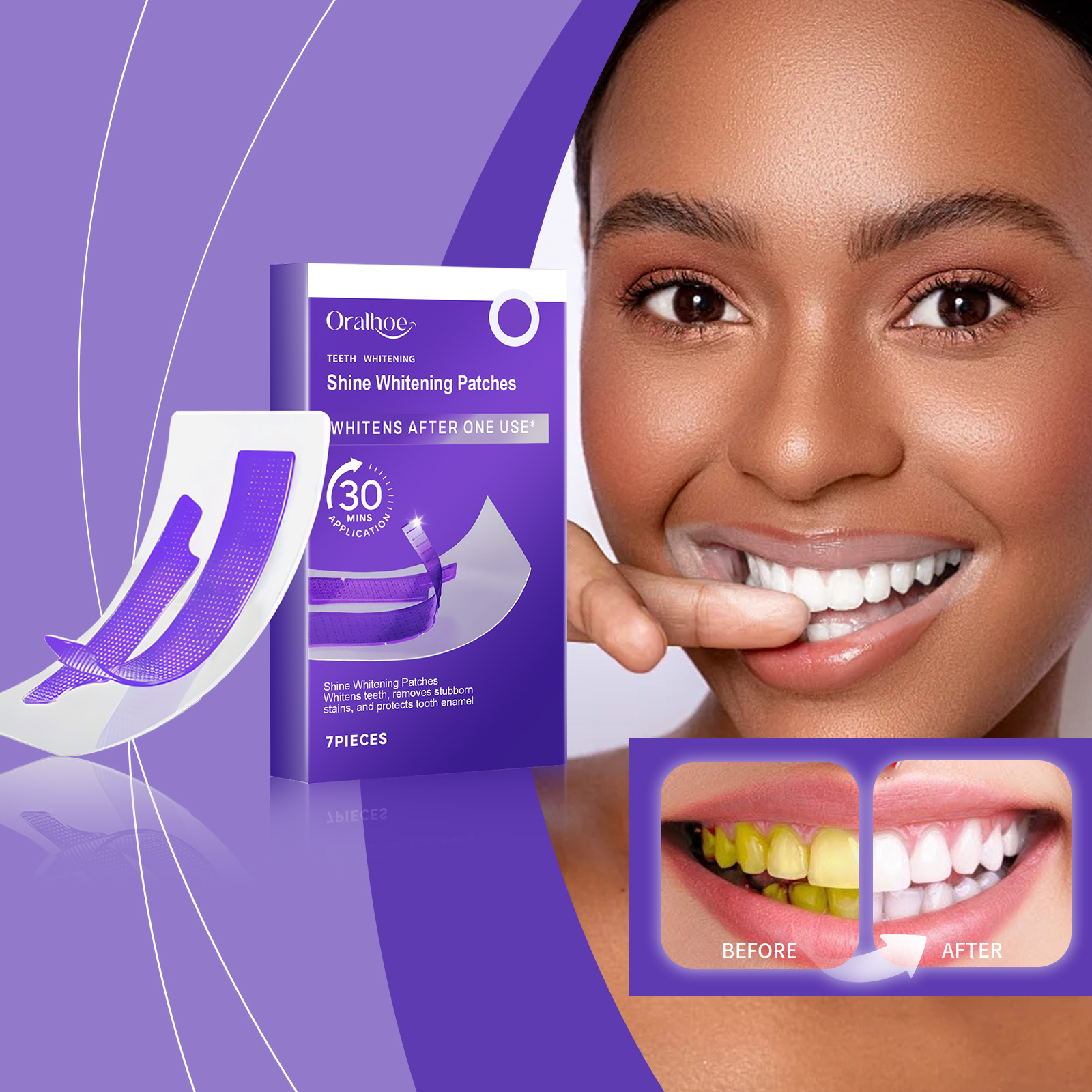 Purple Teeth Whitening Strips  - Teeth Whitening Retainer review and price