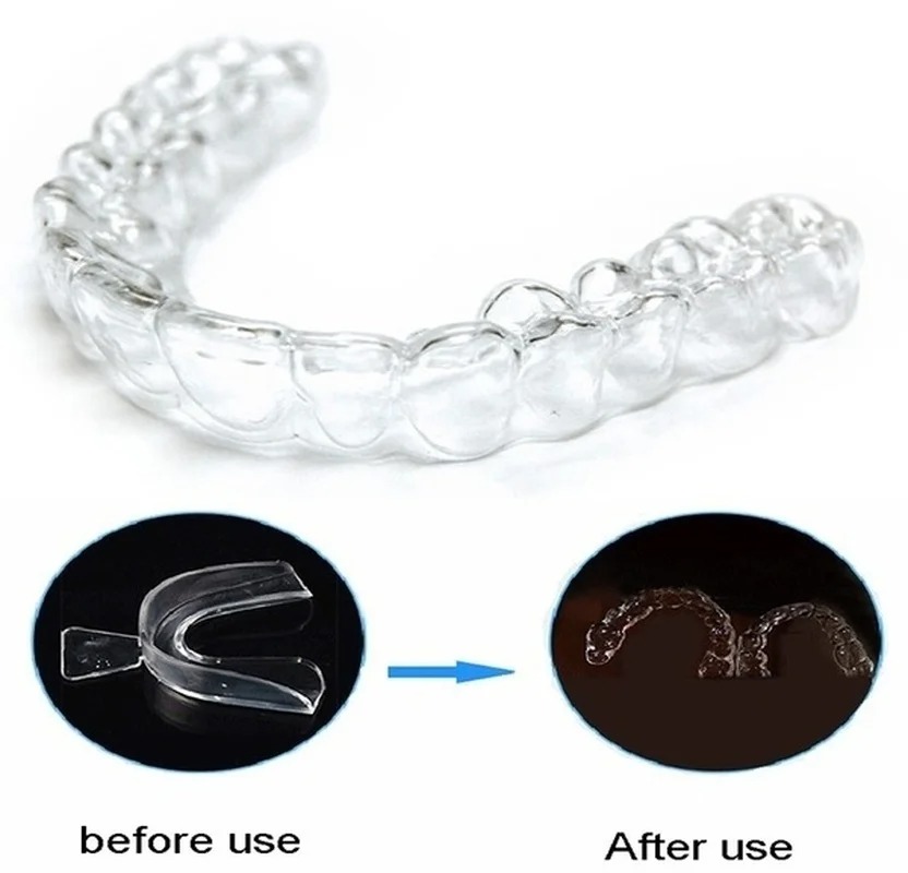 Anti Snoring Bruxism Sleeping  - Teeth Whitening Retainer review and price