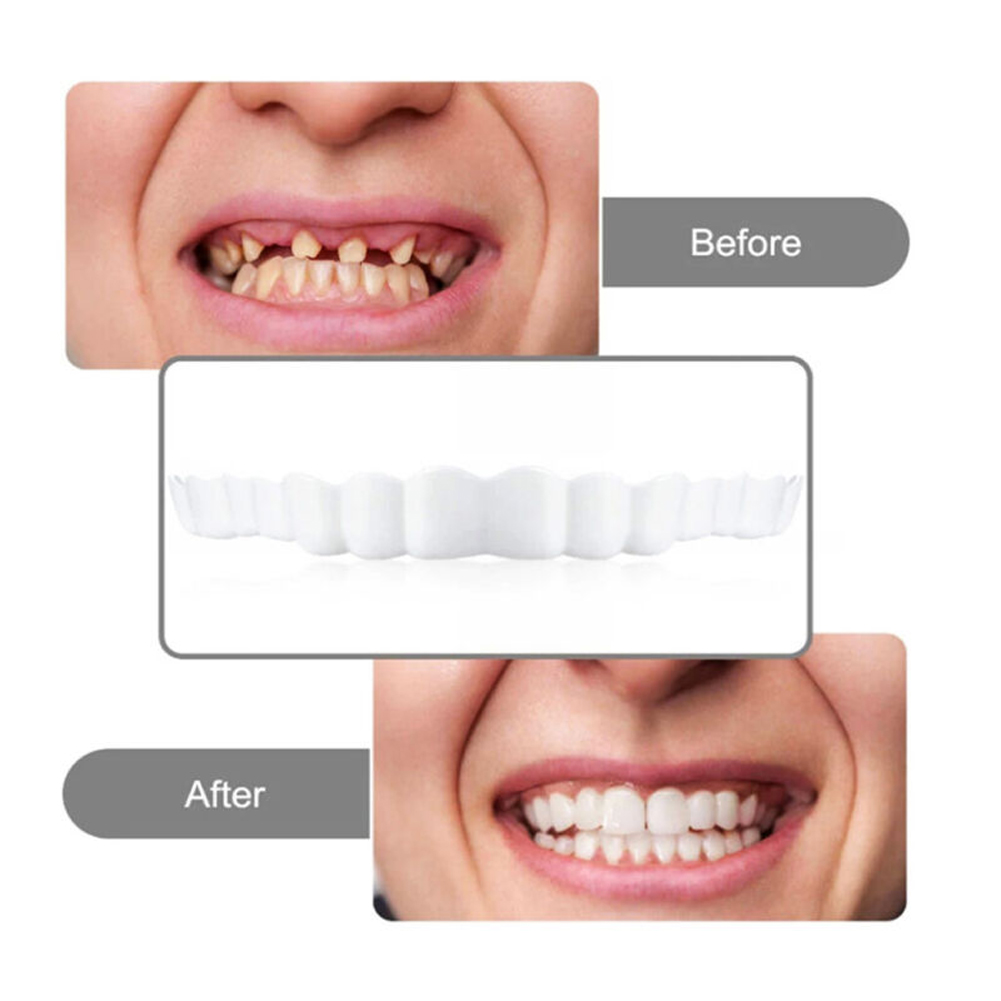 4-6 Pairs Upper&Lower Jaw Dent - Teeth Whitening Mask review and price