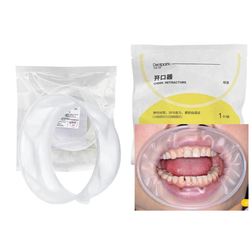 20Pcs Dentpark O-Shape Oral Ch - Teeth Whitening Clinic review and price