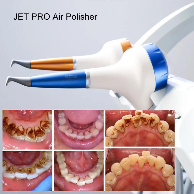 VV Dental  Air Polishing Proph - Teeth Whitening Free review and price