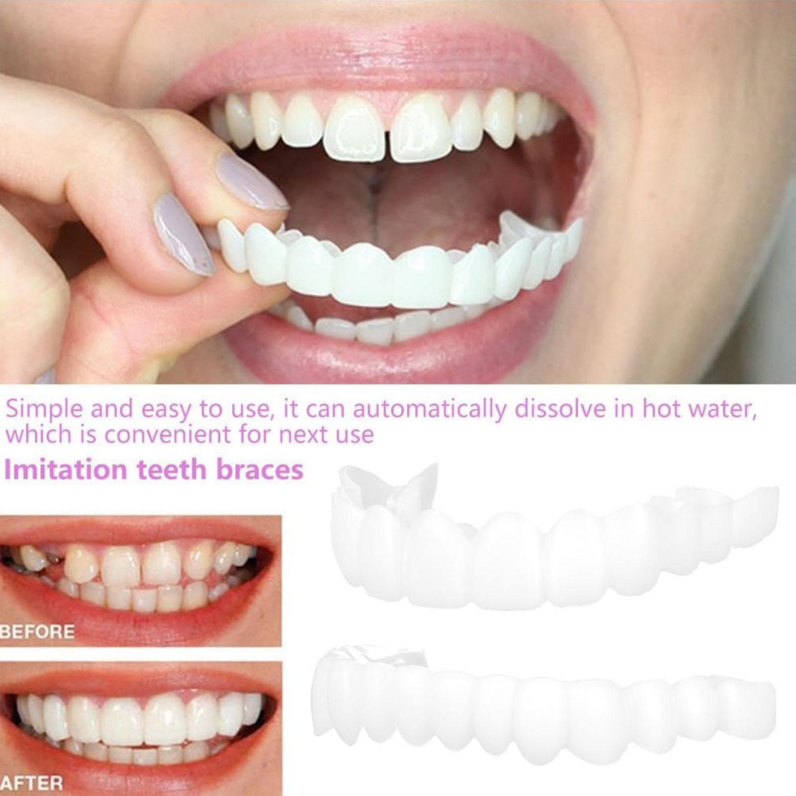 2pcs Men Women Temporary Teeth - Teeth Whitening Mask review and price
