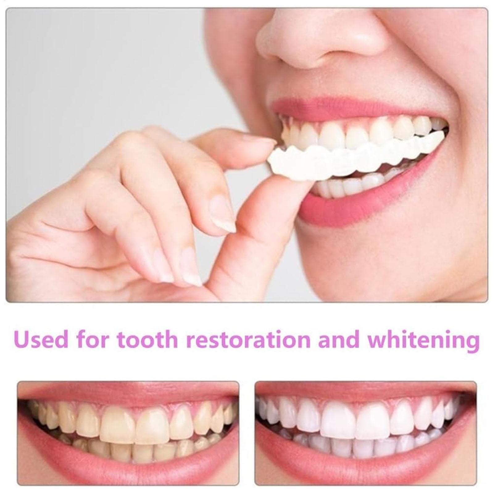 2pcs Men Women Temporary Teeth - Teeth Whitening Mask review and price